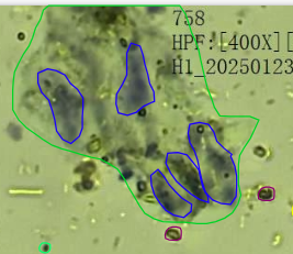 incorrect-annotation.png